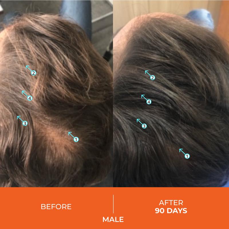 Revita Shampoo For Thinning Hair - Volumizing, Thickening Haircare for Men and Women, Supports Hair Growth, Hair Strengthening, Sulfate Free