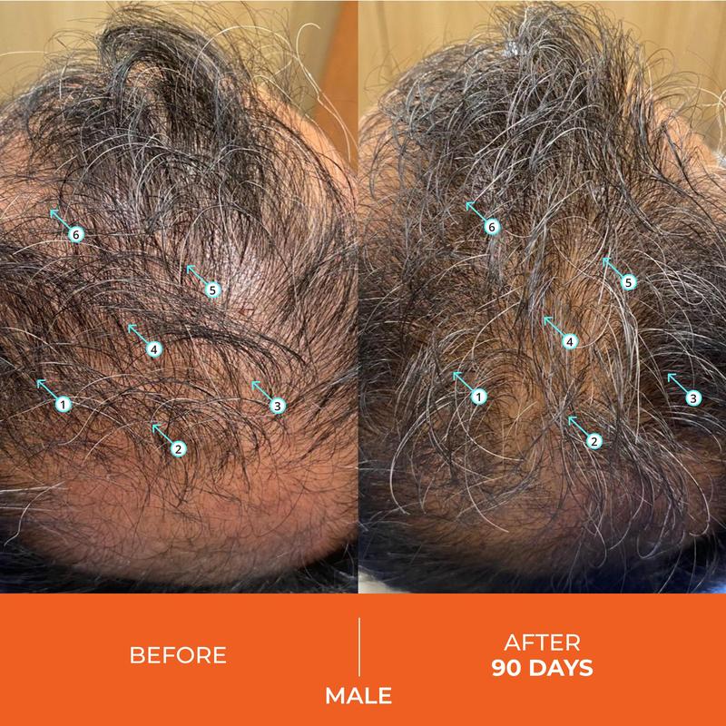 Revita Shampoo For Thinning Hair - Volumizing, Thickening Haircare for Men and Women, Supports Hair Growth, Hair Strengthening, Sulfate Free