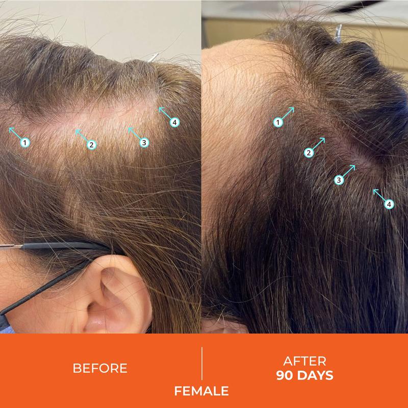 Revita Shampoo For Thinning Hair - Volumizing, Thickening Haircare for Men and Women, Supports Hair Growth, Hair Strengthening, Sulfate Free